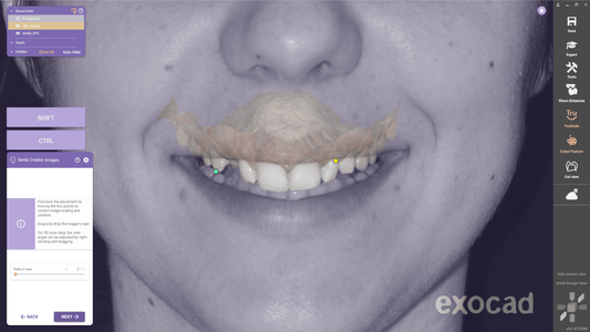 Facially-Driven Smile Designs: A virtual introductory training series