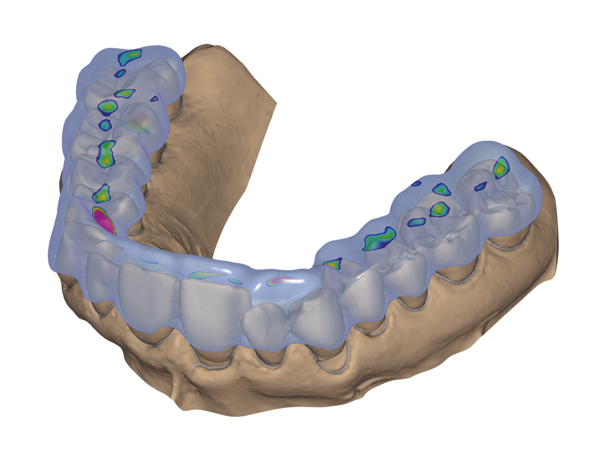 exocad DentalCAD-flex Ultimate Lab Bundle