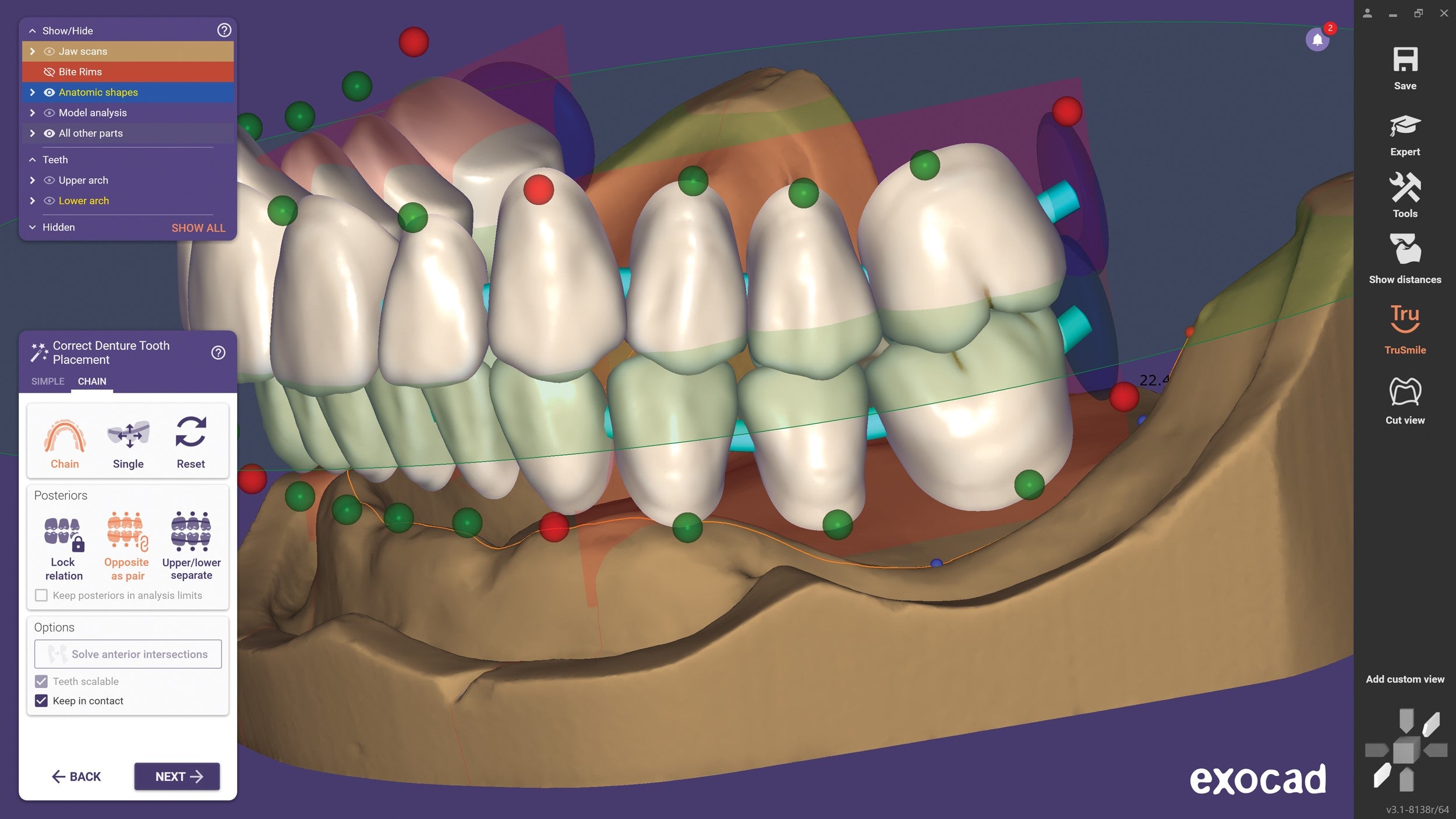 exocad DentalCAD-flex Ultimate Lab Bundle – InstaRisa